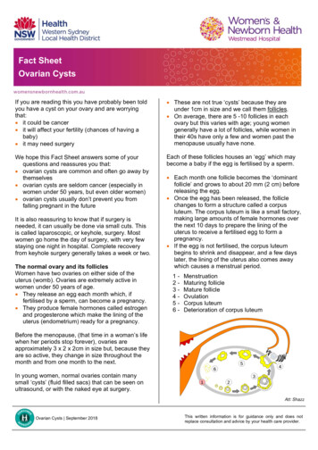 Fact Sheet Ovarian Cysts - Home - WSLHD
