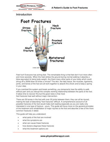 A Patient's Guide To Foot Fractures - Physical Therapy CT