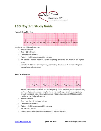 ECG Rhythm Study Guide - LifeSaver CPR