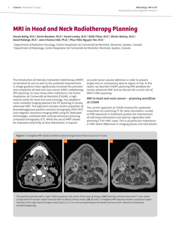 MRI In Head And Neck Radiotherapy Planning