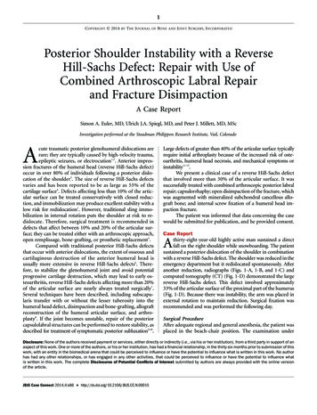 Posterior Shoulder Instability With A Reverse Hill-Sachs Defect: Repair .
