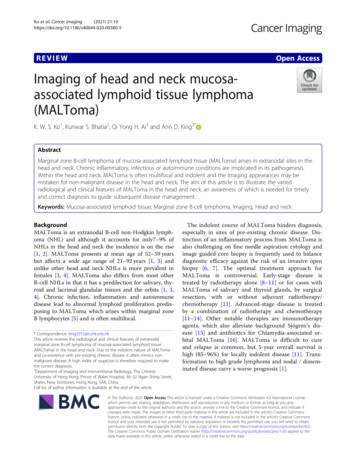Imaging Of Head And Neck Mucosa-associated Lymphoid 