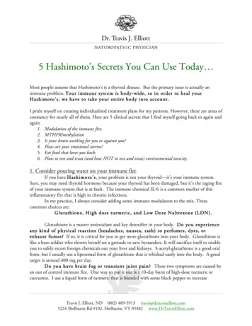 5 Hashimoto’s Secrets You Can Use Today 