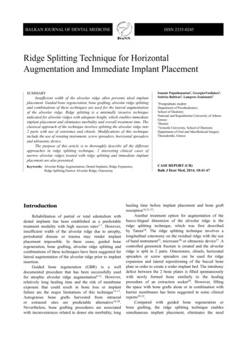 Ridge Splitting Technique For Horizontal Augmentation And Immediate .