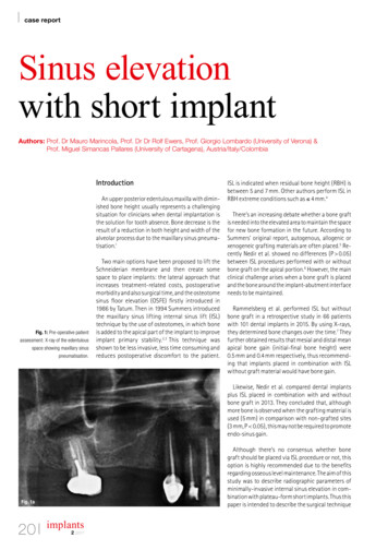 Case Report Sinus Elevation With Short Implant