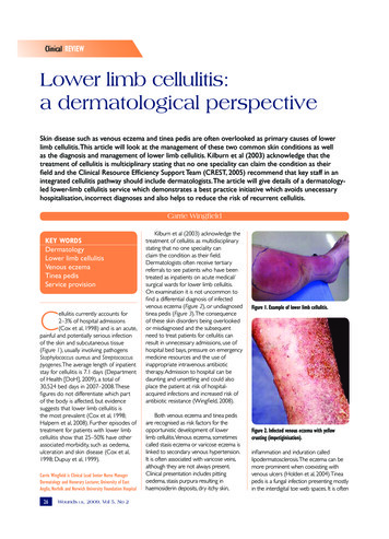 Lower Limb Cellulitis: A Dermatological Perspective