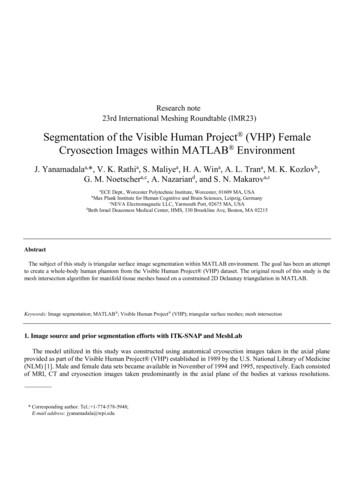 Segmentation Of The Visible Human Project (VHP) Female Cryosection .