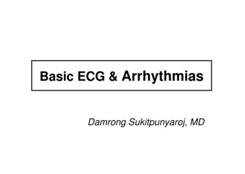 Basic ECG & Arrhythmias