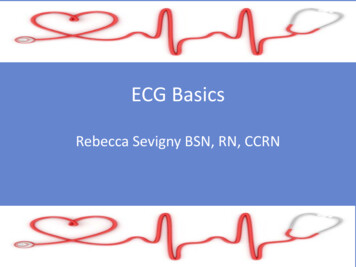 ECG Basics - BC