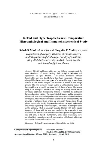 Keloid And Hypertrophic Scars: Comparative Histopathological And . - Kau