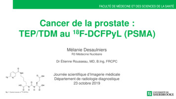 Cancer De La Prostate : TEP/TDM Au 18F-DCFPyL (PSMA)