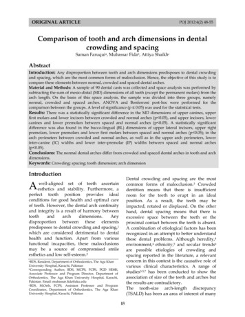 Comparison Of Tooth And Arch Dimensions In Dental Crowding And Spacing