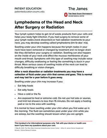 Lymphedema Of The Head And Neck After Surgery Or Radiation