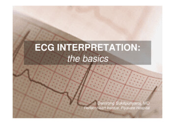ECG INTERPRETATION:ECG INTERPRETATION