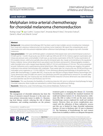Melphalan Intra-arterial Chemotherapy For Choroidal Melanoma Chemoreduction