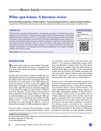 White Spot Lesions: A Literature Review - Jpdent 