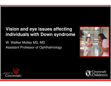 Vision And Eye Issues Affecting Individuals With Down 